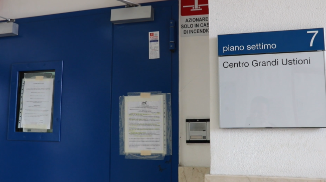Post Pasqua “di fuoco” nel Catanese, il dott. Ranno illustra le condizioni dei 4 ustionati – VIDEO