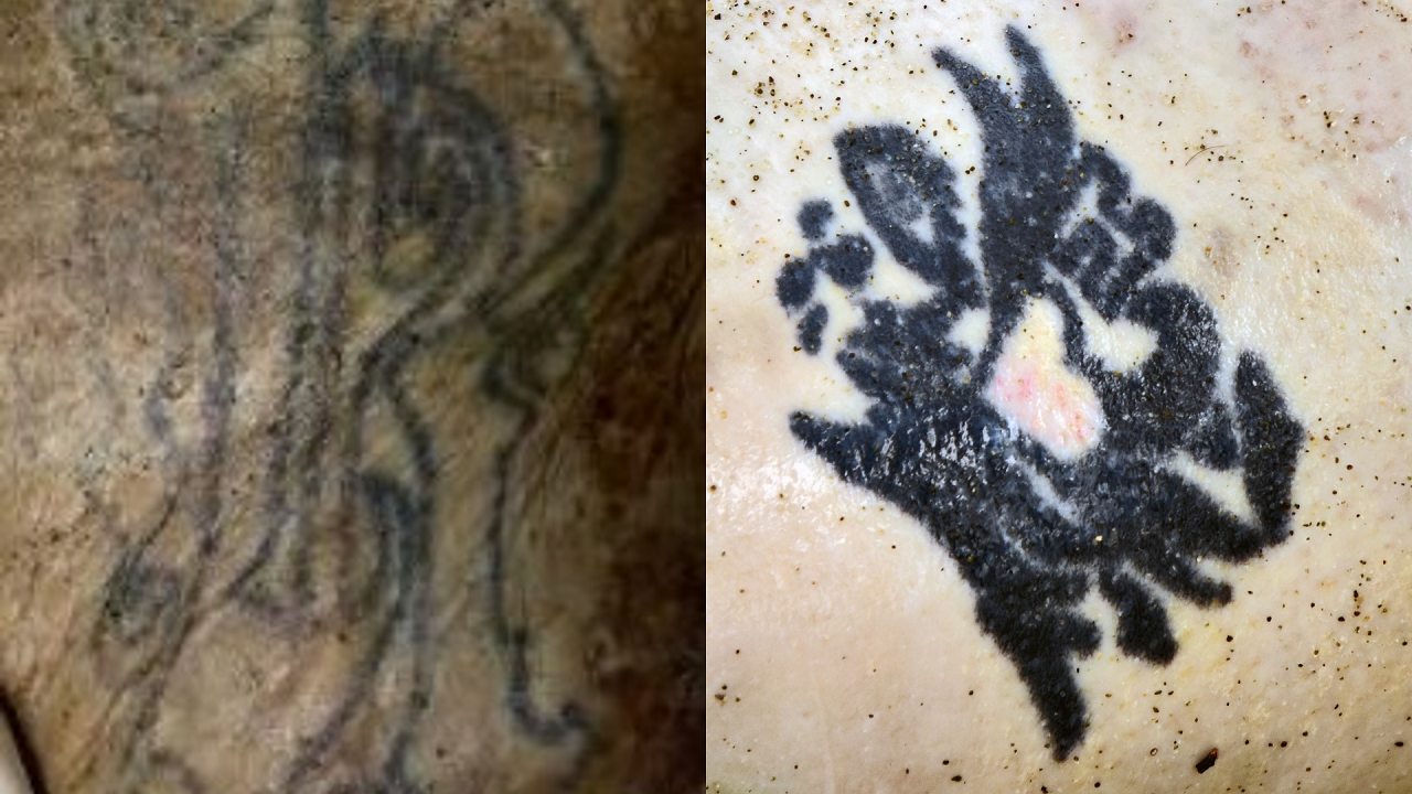 Cadavere sulla battigia di Rodia, indagini in corso per l’identificazione: focus sui tatuaggi