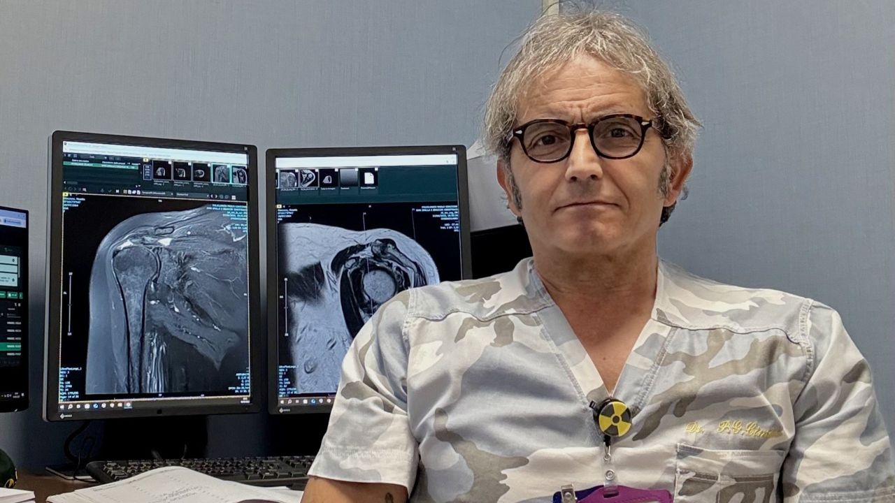 Una nuova terapia per l’artrosi della mano al Policlinico di Palermo