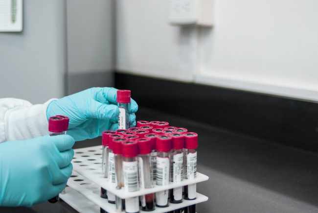 La crisi dei laboratori analisi in Sicilia e i budget al limite: la denuncia di Federbiologi
