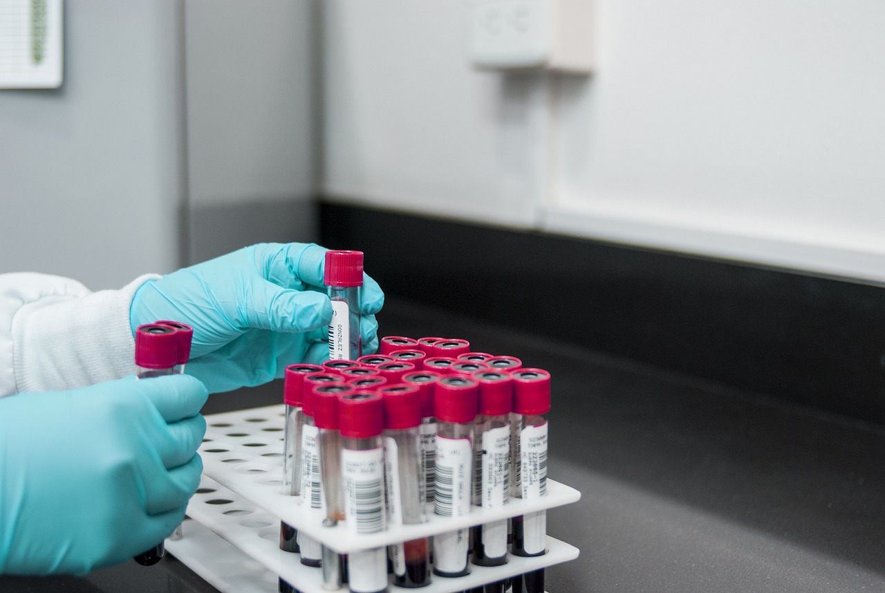 La crisi dei laboratori analisi in Sicilia e i budget al limite: la denuncia di Federbiologi