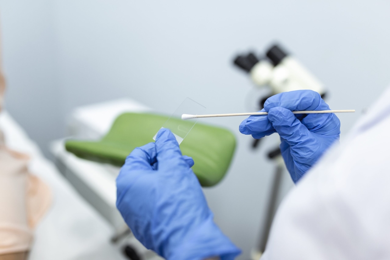Screening oncologici al palo: in Sicilia adesioni ancora troppo basse
