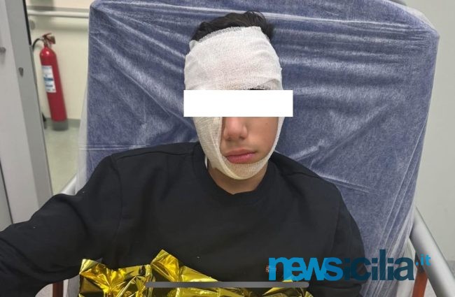Baby gang picchia 14enne in Piazza Stesicoro. “Mio figlio pestato per passatempo”, lo sfogo del padre