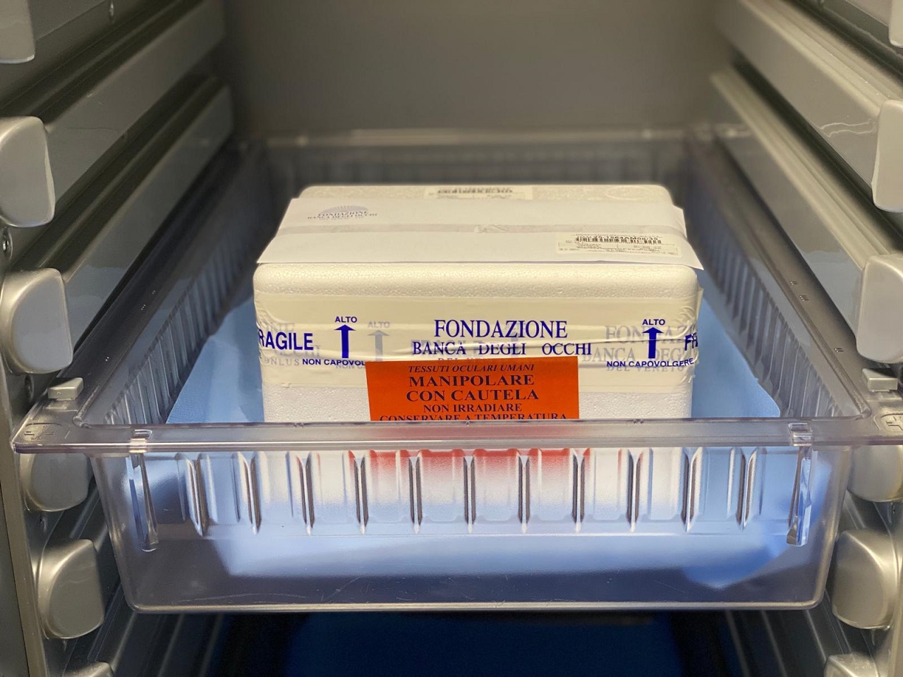 All’Ospedale Gravina di Caltagirone arriva la prima cornea donata