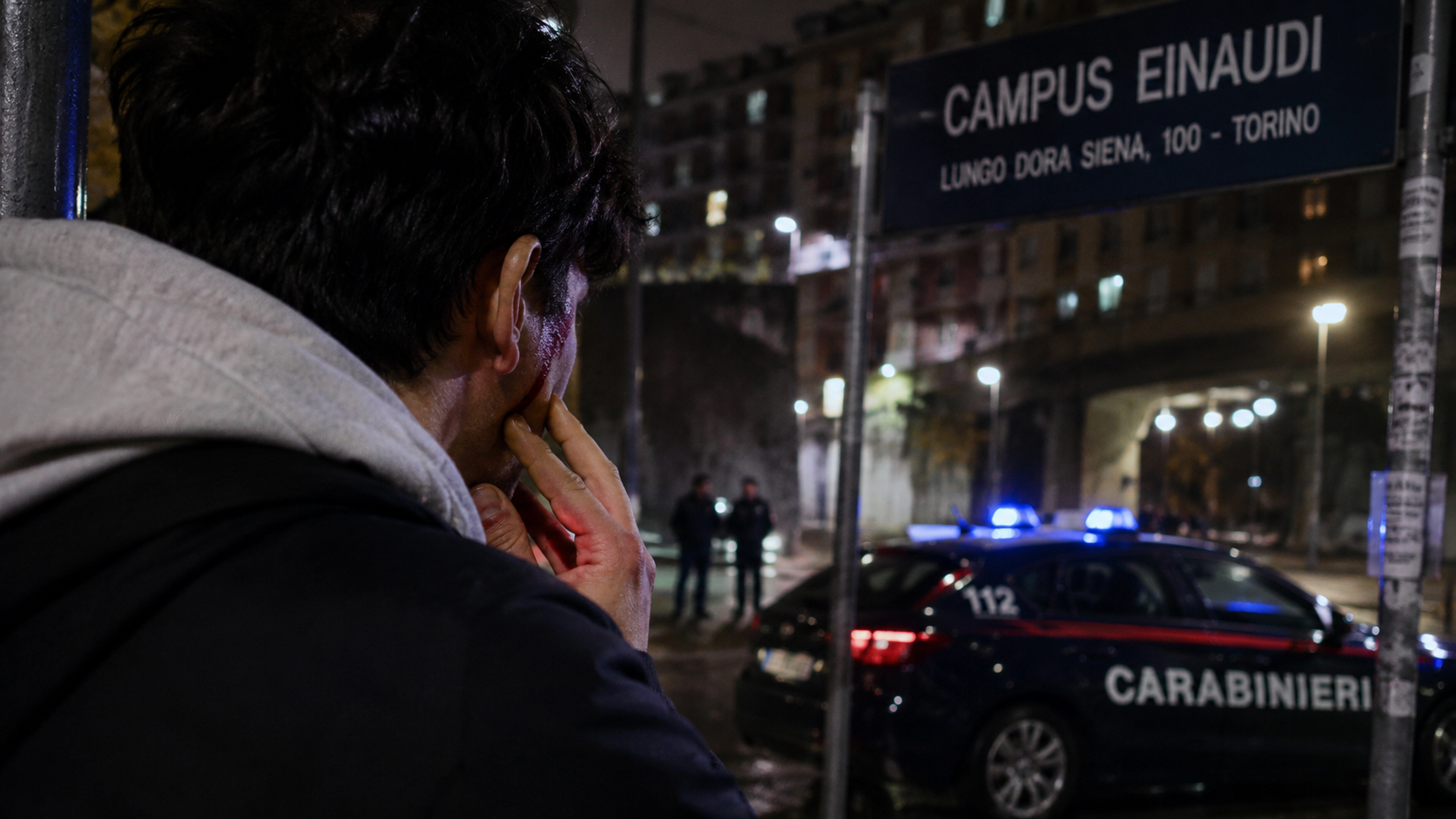 Torino, giovane siciliano pestato: «Ci hanno chiamati terroni, poi mi hanno massacrato»