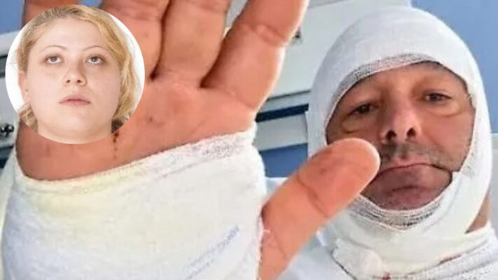 Avvocato aggredito con liquido corrosivo, convalidato il fermo: Maria Grazia Messina resta in carcere